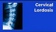 Cervical Lordosis - What Is It and What Is It And Why Is It Important - Tebby Clinic