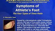Symptoms Of Athlete's Foot
