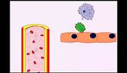 USMLE Animated Immunology - Infection & Acute Inflammation - Monocytes & Macrophages