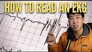 How To Read An EKG In 2023 (High Yield)
