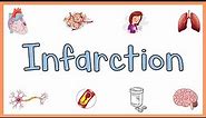 Infarction : Causes, Types, Morphology & Factors influencing development of infarction
