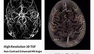 Brain MR Angiography at 7T, GE SIGNA!... - MRI Technologist