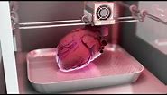 How medical 3D printing could solve the shortage of organ donations