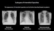 How to Interpret a Chest X-Ray (Lesson 7 - Diffuse Lung Processes)