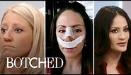 5 Most Heartbreaking Nose Jobs | Botched | E!