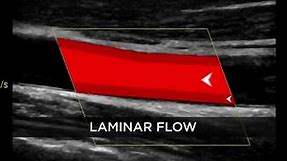 Doppler Ultrasound of the Carotid... - Concierge Diagnostics