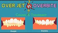 Overjet vs Overbite (Deep Bite) - EXPLAINED IN 3 MINUTES!