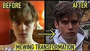 8 MONTH MEWING TRANSFORMATION VIDEO | 19 YEARS OLD BEFORE AND AFTER
