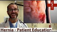 HERNIA - patient education video by Dr. Carlo Oller