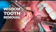 Wisdom tooth removal in 5 MIN or less. Surgical Guide: Online Course + Free e-Book!