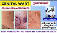 The Ultimate Cure: Homeopathic Medicine for Genital Warts