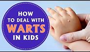 How to Deal With Warts In Children