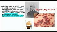 Kaposi Sarcoma lecture Pathogenesis, clinical features, histopathology- EVERYTHING you need to know
