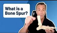 What Is a Bone Spur?? | Identifying Foot Pain Problems
