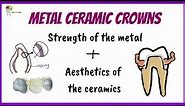 METAL CERAMIC CROWNS | How metal bonds to ceramic | Prosthodontics