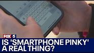 Is 'Smartphone pinky' a real thing?