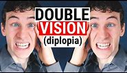 What Causes DOUBLE VISION (Diplopia) | 5 Common Causes for Diplopia | Doctor Eye Health