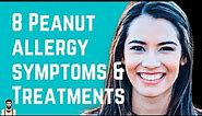 8 Peanut Allergy Symptoms and Treatments – The Root Problem