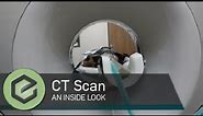 CT Scan- An inside look