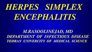 PPT - HERPES SIMPLEX ENCEPHALITIS PowerPoint Presentation, free download - ID:3311706