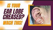 Detecting Heart Disease with Earlobe Crease: What Research Says