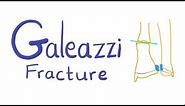 Galeazzi Fracture