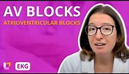 Atrioventricular Blocks (AV Blocks) - EKG Interpretation | @LevelUpRN