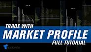 How To Use Market Profile [START NOW] | Trading Tutorials