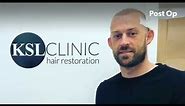 Steven Fletcher FUE Hair Transplant Journey with KSL Clinic