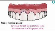 Parts Of Gingiva (Easy)