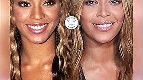 What plastic surgery has Beyonce had? #shorts