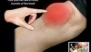 Knee Bursitis - Everything You Need To Know - Dr. Nabil Ebraheim