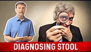 Types of Stool : Size, Shape & Color – Stool Analysis by Dr. Berg