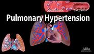 Pulmonary Hypertension, Animation