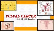 Management of Vulval Cancer, RCOG & BGCS Guidelines