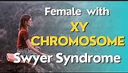 Swyer Syndrome | FEMALE with XY chromosome