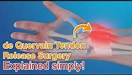 De Quervain Tendon Release Surgery - Explained
