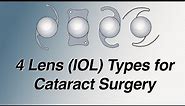 4 Main Lens (IOL) Types for Cataract Surgery: Pros and Cons (Basic Version)