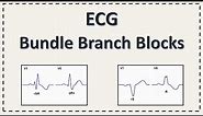 Bundle Branch Block | ECG | Right Bundle Branch Block | Left Bundle Branch Block | Explained