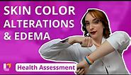 Skin Color Alterations & Edema - Health Assessment |@LevelUpRN