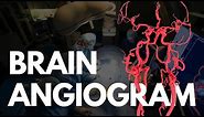 Angiogram - BRAIN angio procedure video