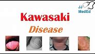 Kawasaki Disease | What is it, symptoms, treatment and complications (ex. heart failure)
