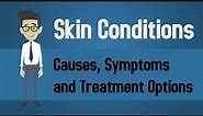 Skin Conditions - Causes, Symptoms and Treatment Options