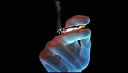Smoking Causes Cancer, Heart Disease, Emphysema