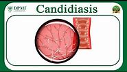 Candidiasis: What is Candidiasis? Candida Species– Morphology? Pathogenesis of Candida Albicans