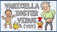 Varicella zoster virus: Chicken Pox and Shingles (herpes zoster)