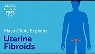 Mayo Clinic Explains Uterine Fibroids
