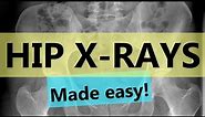 How to read hip x-rays | EASY GUIDE