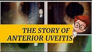 The story of ANTERIOR UVEITIS || iritis ,cyclitis and iridocyclitis || Signs & symptoms and more..