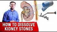 How To Dissolve Kidney Stones Explained By Dr.Berg